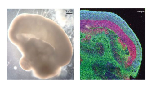 resize brain organoid Mad lab montage